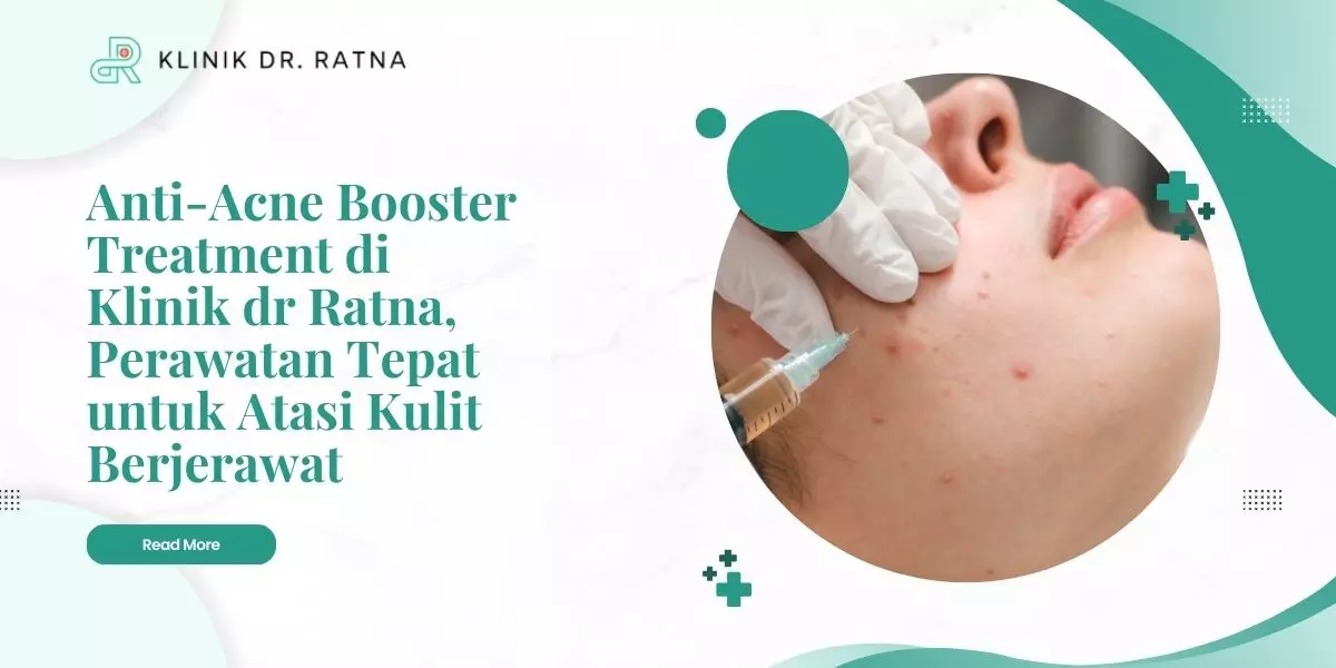 Anti-Acne Booster Treatment di Klinik dr Ratna, Perawatan Tepat untuk Atasi Kulit Berjerawat