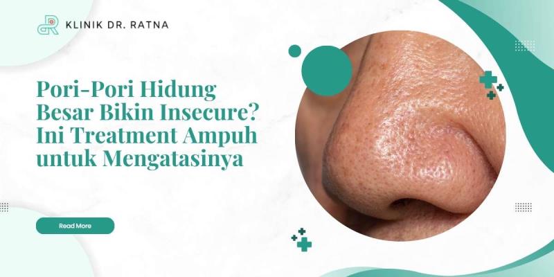 Pori-Pori Hidung Besar Bikin Insecure? Ini Treatment Ampuh untuk Mengatasinya