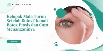 Kelopak Mata Turun Setelah Botox? Kenali Botox Ptosis dan Cara Menanganinya