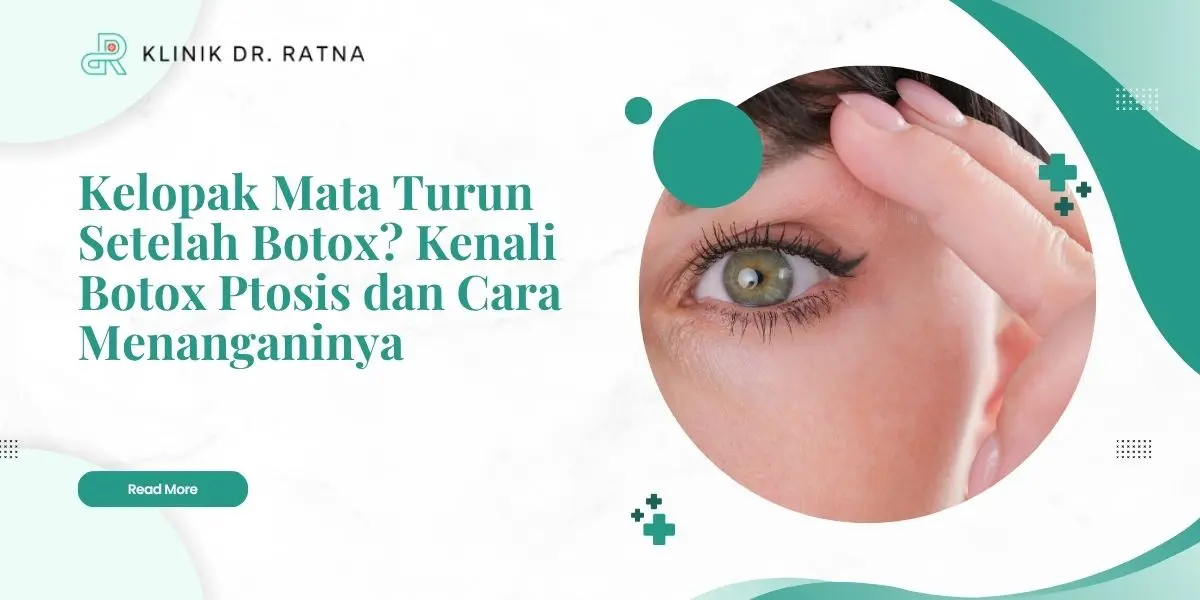 Kelopak Mata Turun Setelah Botox? Kenali Botox Ptosis dan Cara Menanganinya