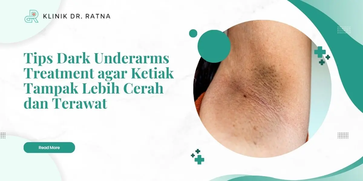 Tips Dark Underarms Treatment agar Ketiak Tampak Lebih Cerah dan Terawat