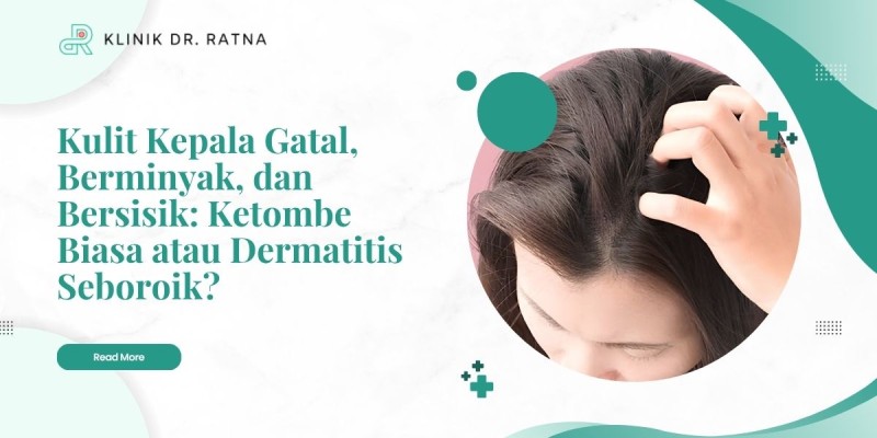 Kulit Kepala Gatal, Berminyak, dan Bersisik: Ketombe Biasa atau Dermatitis Seboroik?