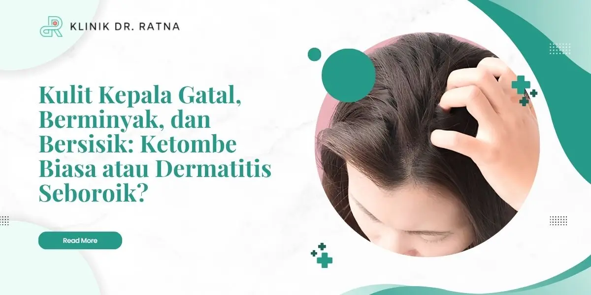 Kulit Kepala Gatal, Berminyak, dan Bersisik: Ketombe Biasa atau Dermatitis Seboroik?