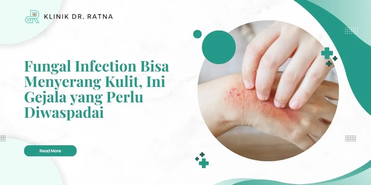 Fungal Infection Bisa Menyerang Kulit, Ini Gejala yang Perlu Diwaspadai
