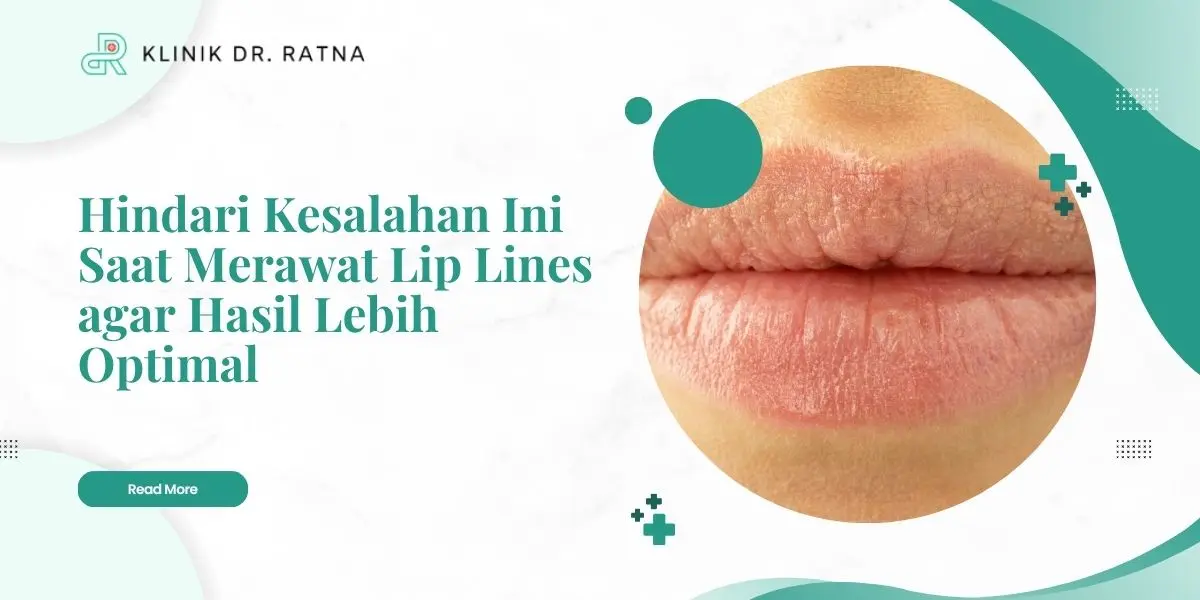Hindari Kesalahan Ini Saat Merawat Lip Lines agar Hasil Lebih Optimal