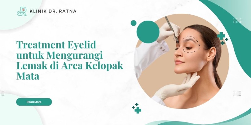 Treatment Eyelid untuk Mengurangi Lemak di Area Kelopak Mata