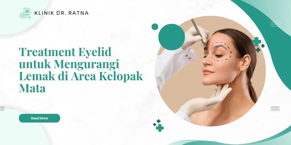 Treatment Eyelid untuk Mengurangi Lemak di Area Kelopak Mata