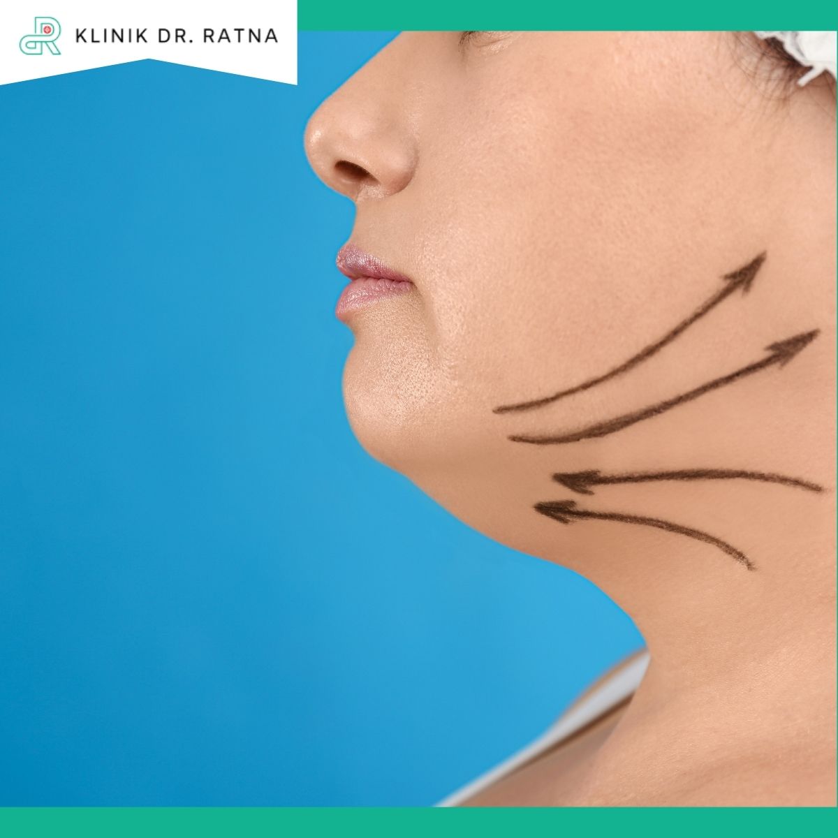 Keunggulan Tuneface Treatment Keunggulan Tuneface Treatment