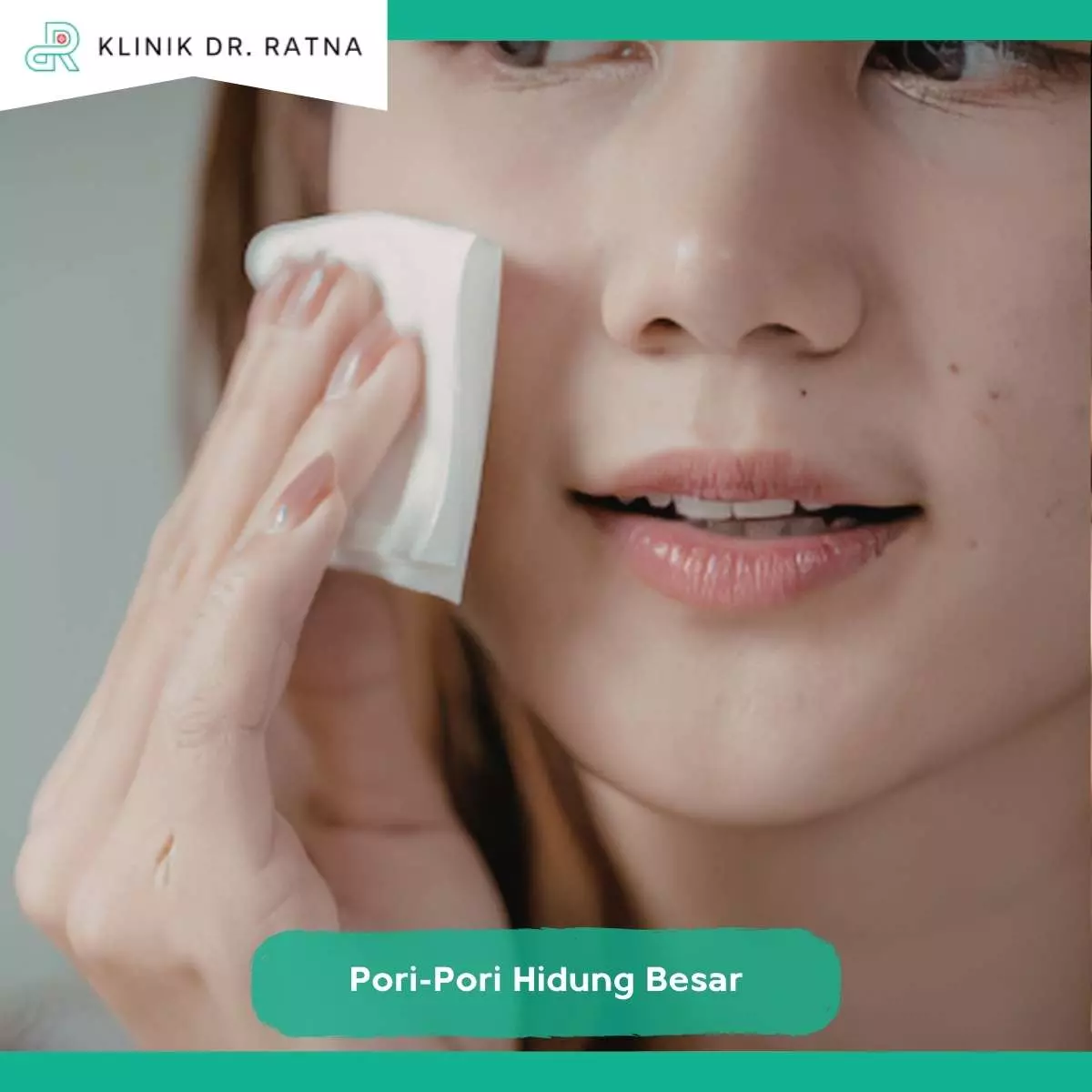Tips Mencegah Pori-Pori Hidung Membesar