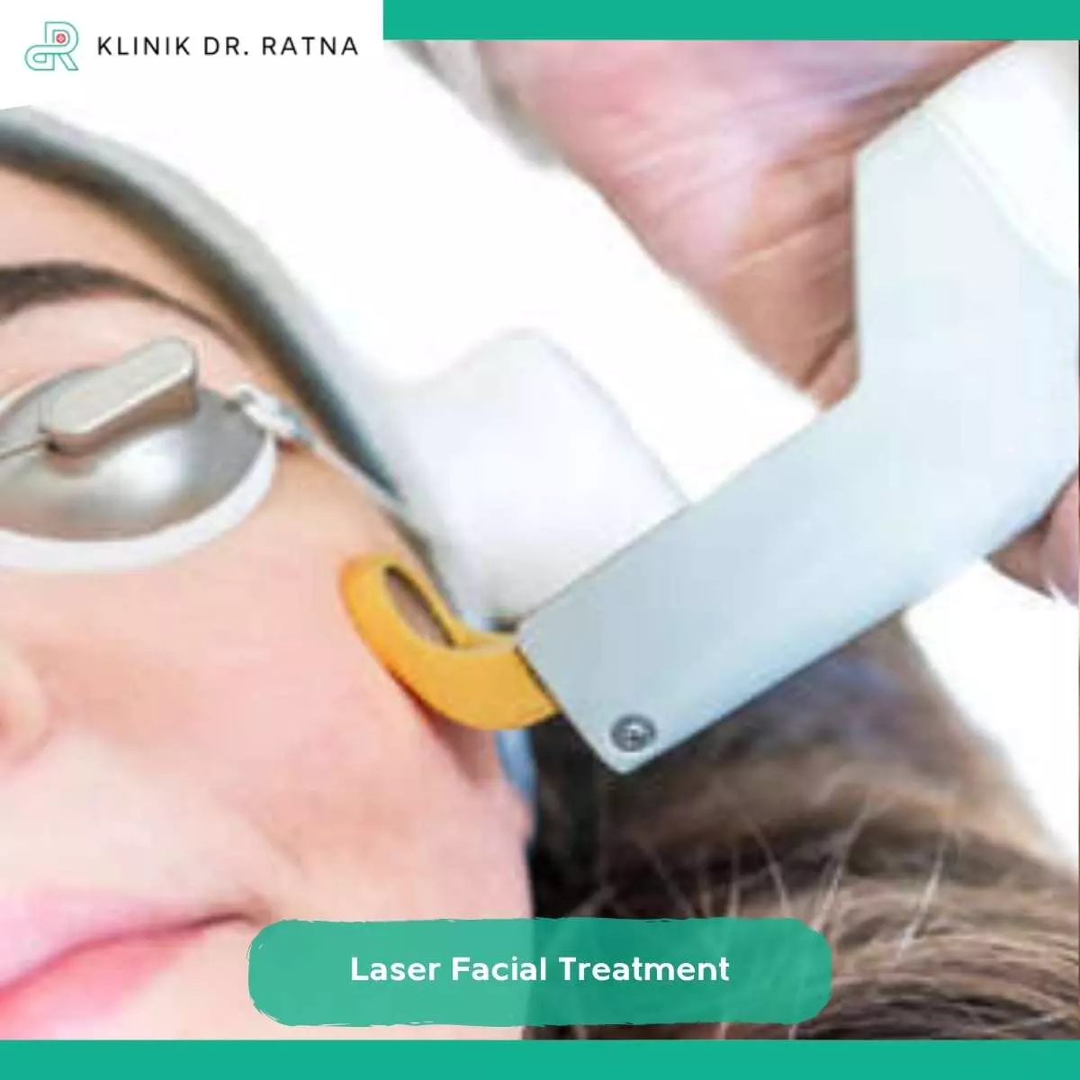 Apa Itu Laser Facial Treatment?