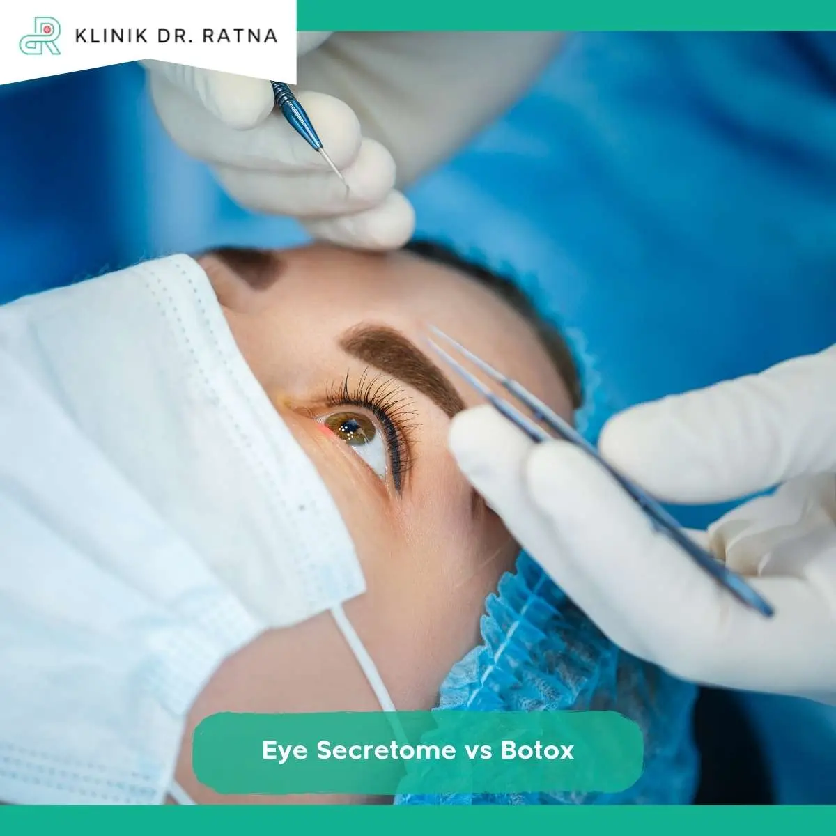 Mengenal Eye Secretome dan Botox Area Mata