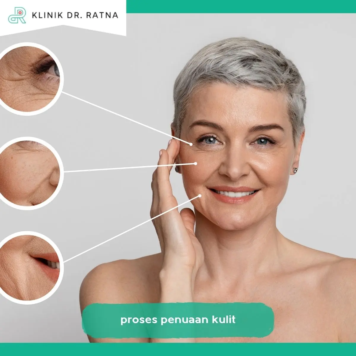 Memahami Proses Penuaan Alami Kulit