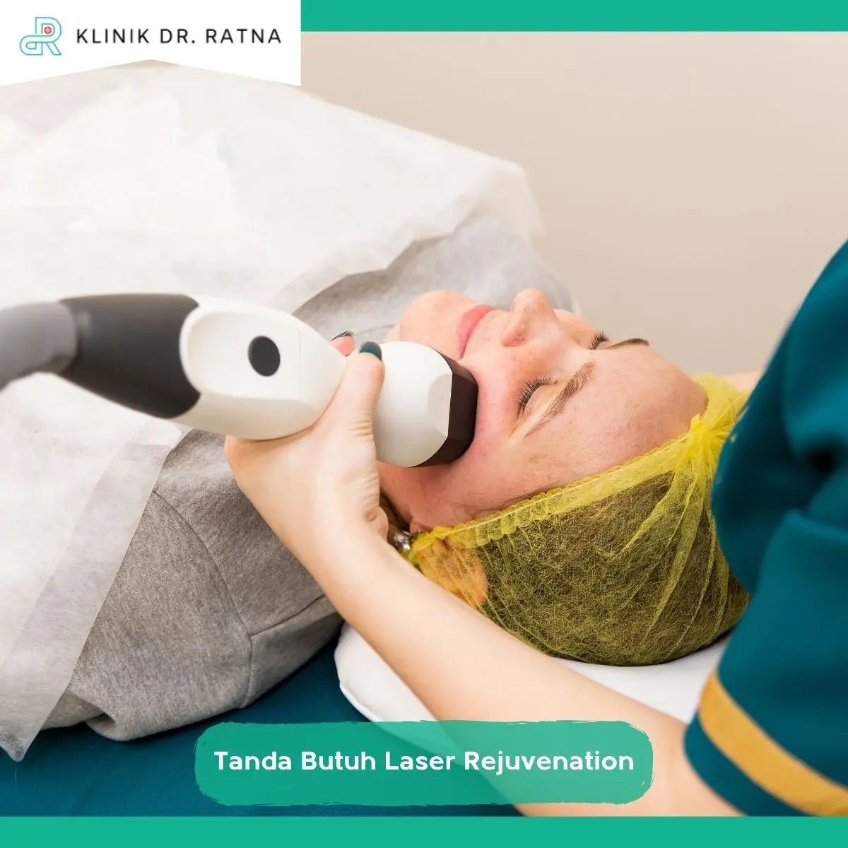 4 Tanda Fisik Kulit Anda Sudah Membutuhkan Laser Rejuvenation