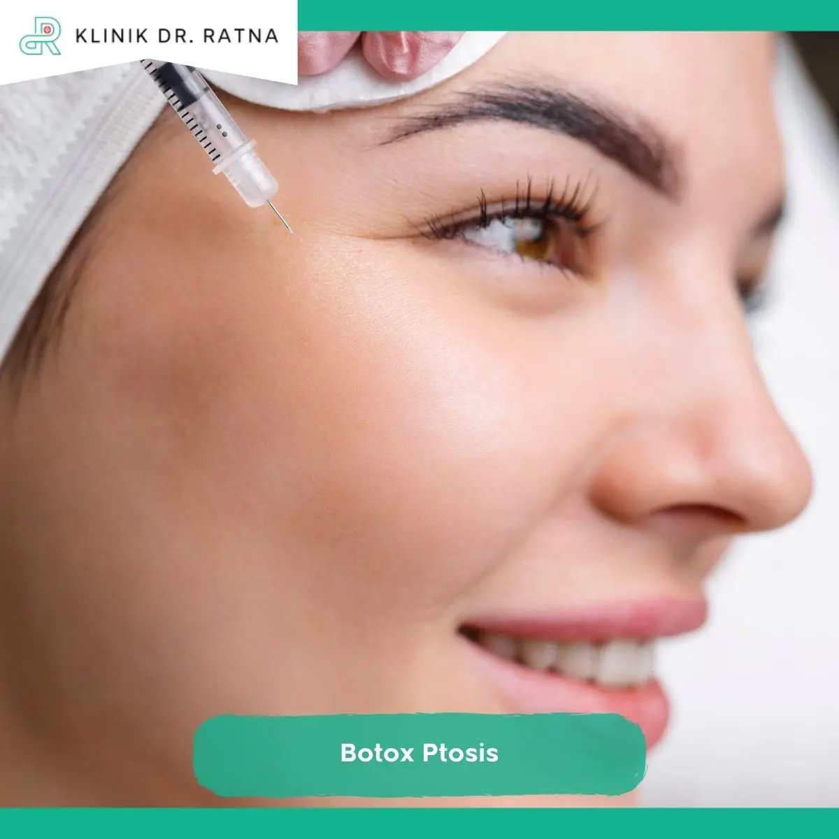 Cara Mencegah Ptosis Sebelum Melakukan Botox