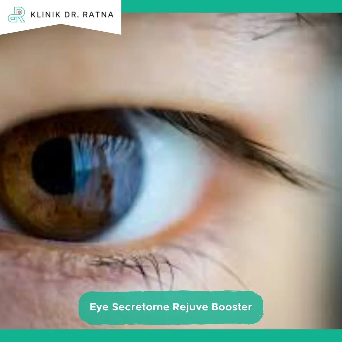 Tips Menjaga Hasil Eye Secretome Rejuve Booster