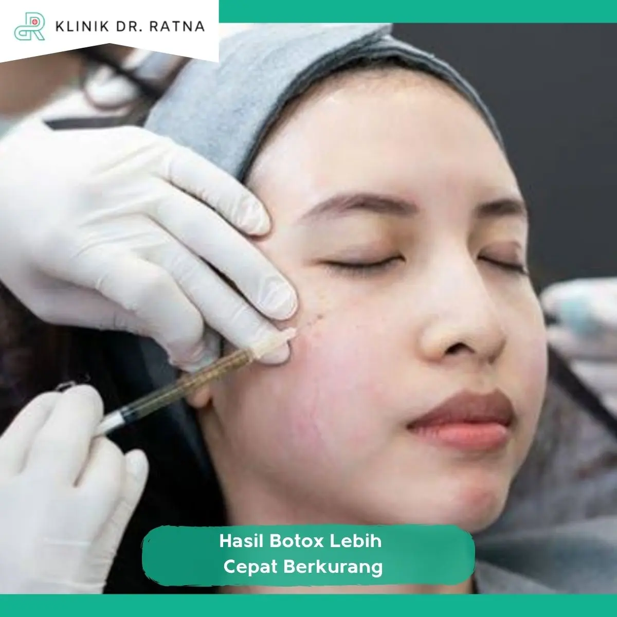 Cara Membantu Mempertahankan Hasil Botox