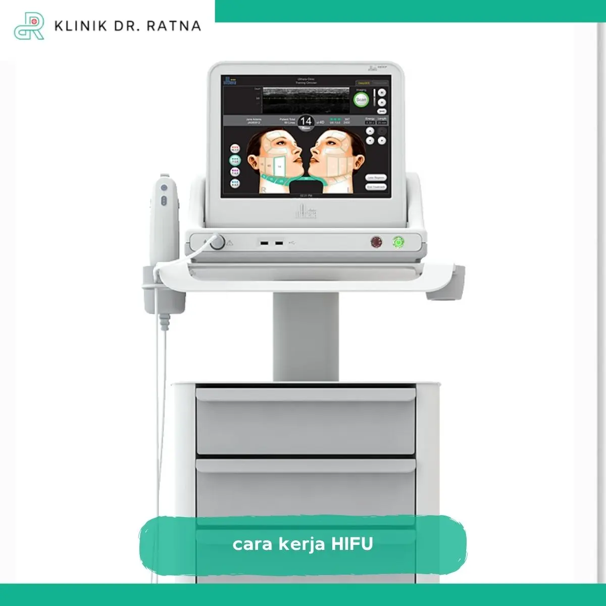 Bagaimana dengan HIFU?