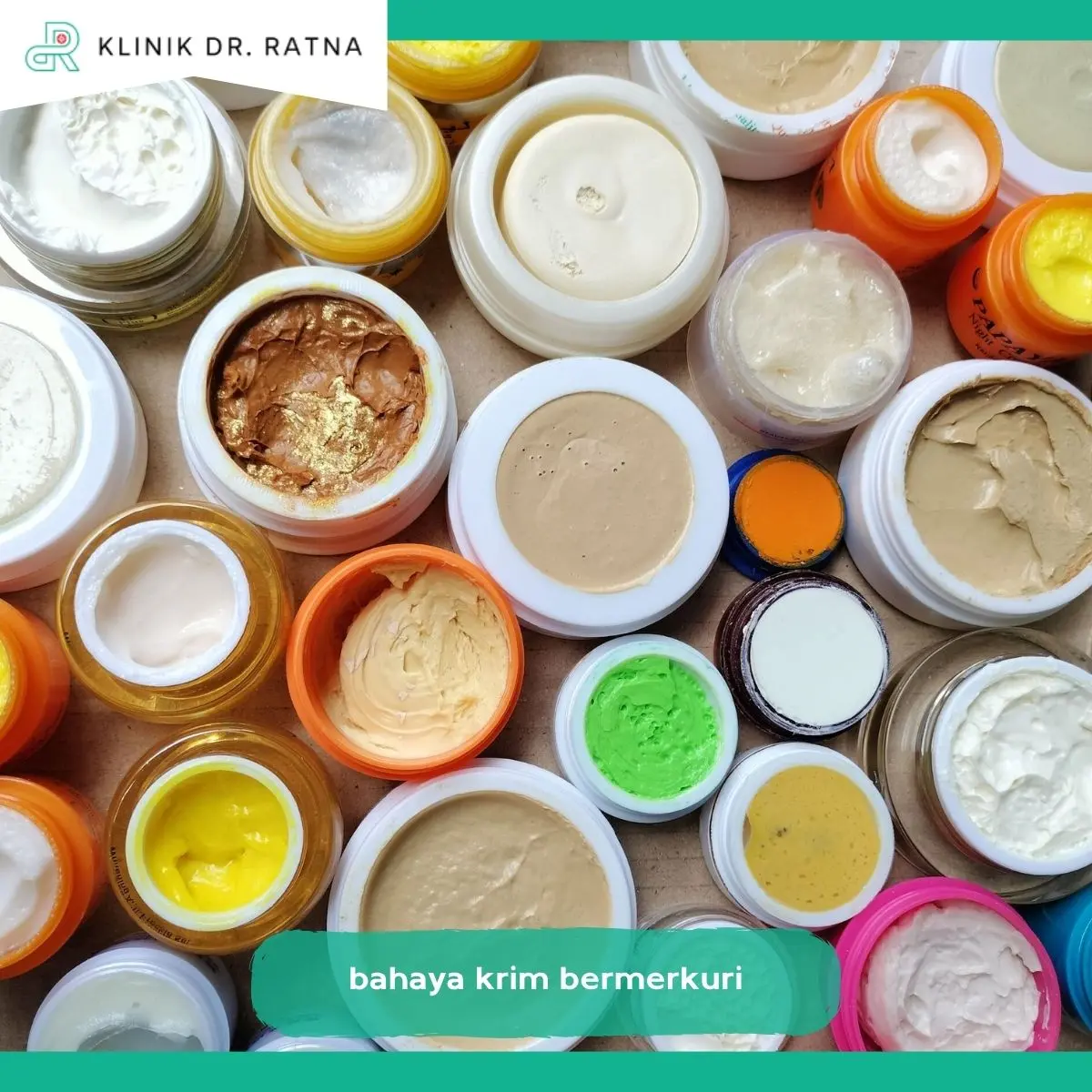 Bahaya Merkuri Tidak Hanya Mengenai Wajah