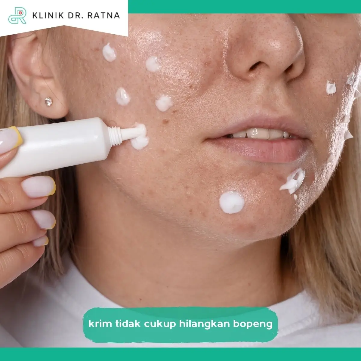 Mengapa Krim Saja Biasanya Tidak Cukup?
