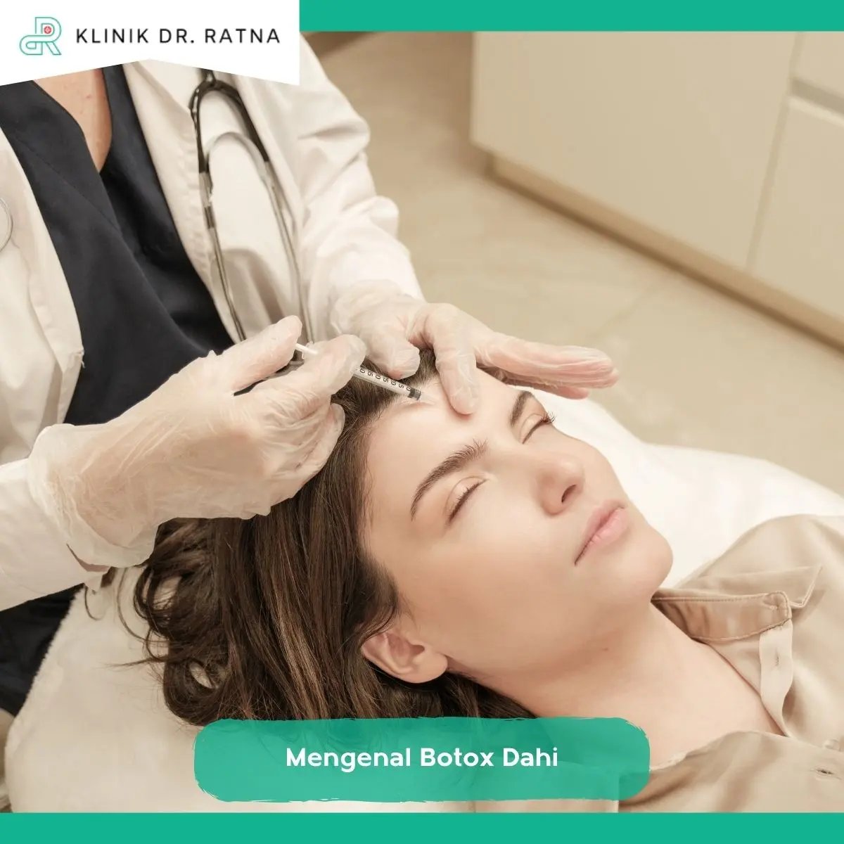 Apa Itu Botox Dahi dan Bagaimana Cara Kerjanya?