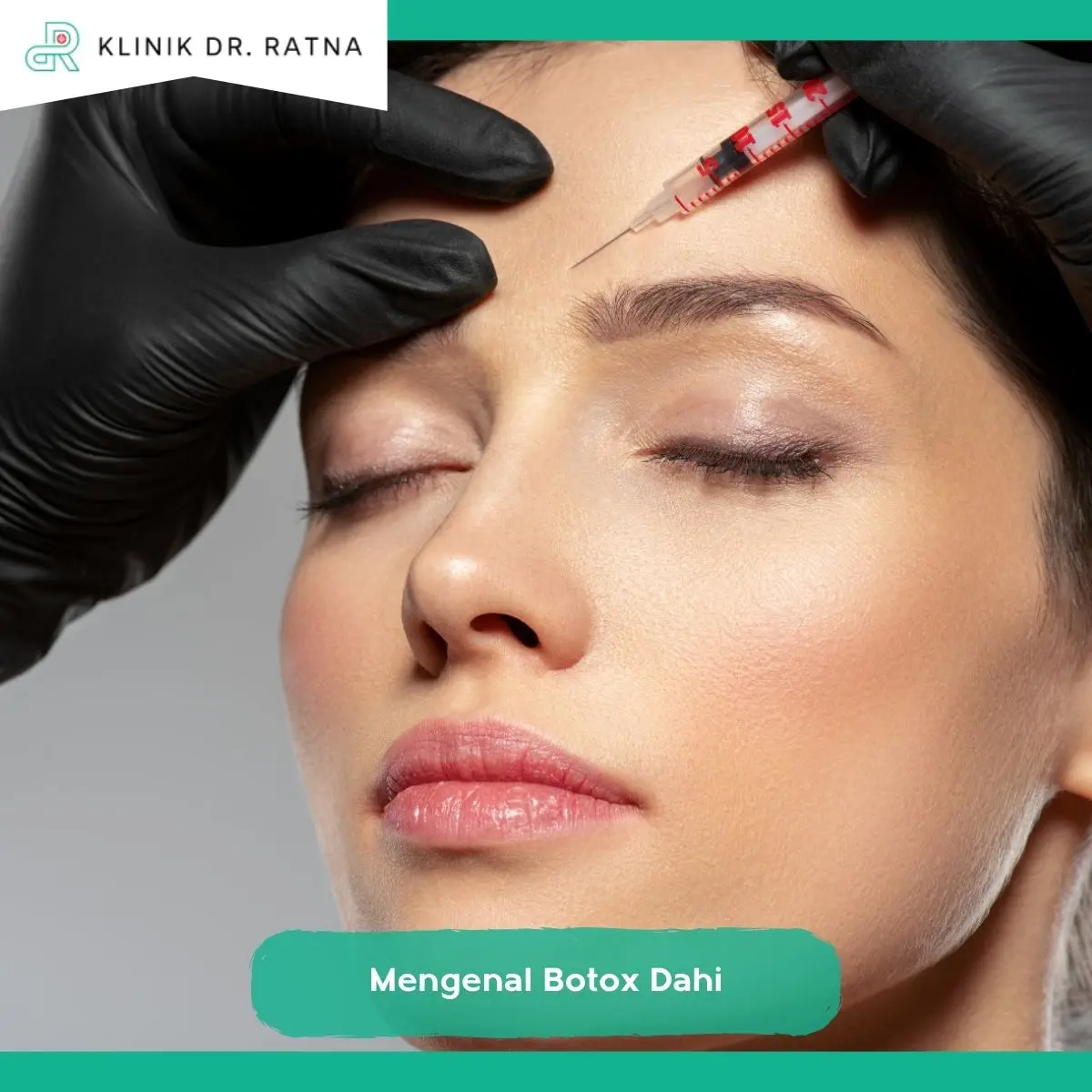 Botox Dahi vs Treatment Kerutan Lainnya, Mana yang Lebih Tepat?