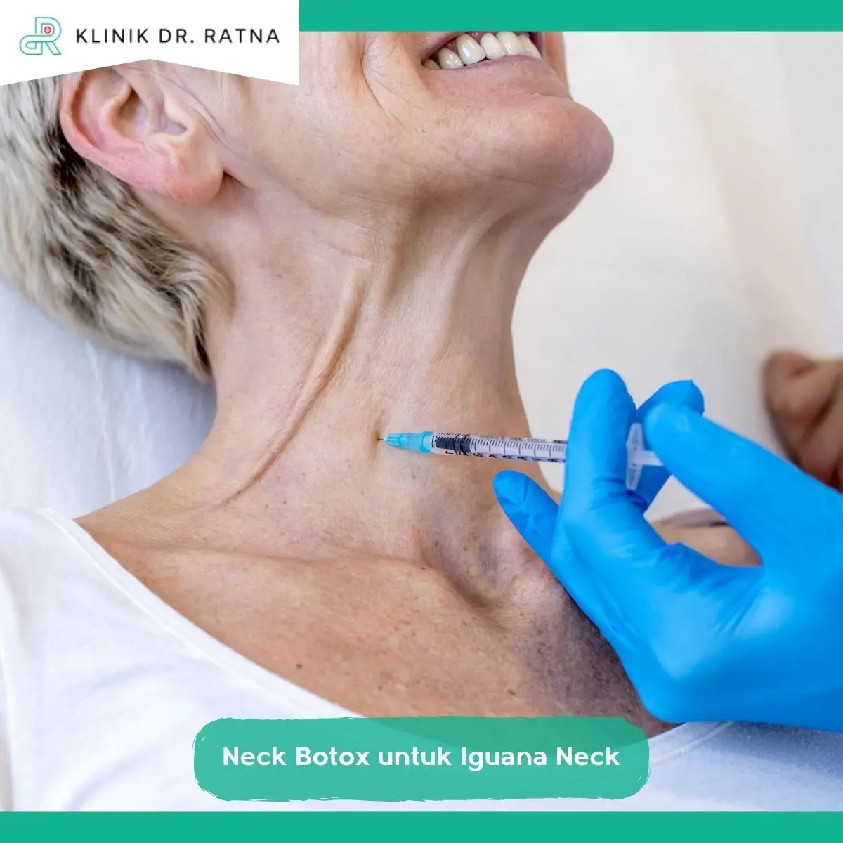 Mengenal Botox Leher dan Cara Kerjanya pada Otot Platysma