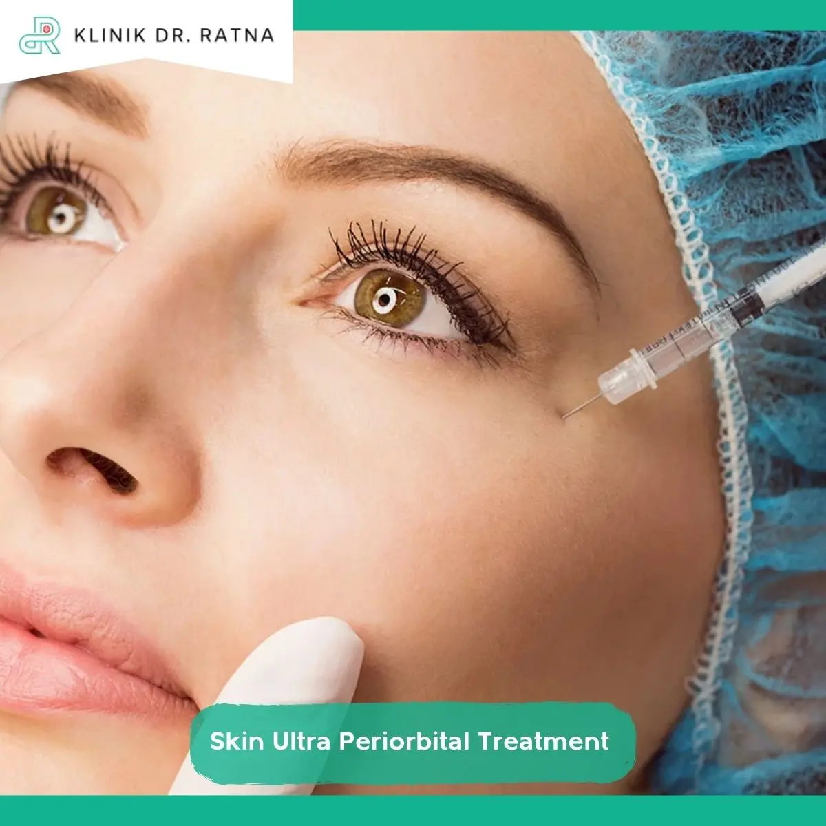 Bagaimana Prosedur Skin Ultra Periorbital Treatment Dilakukan?