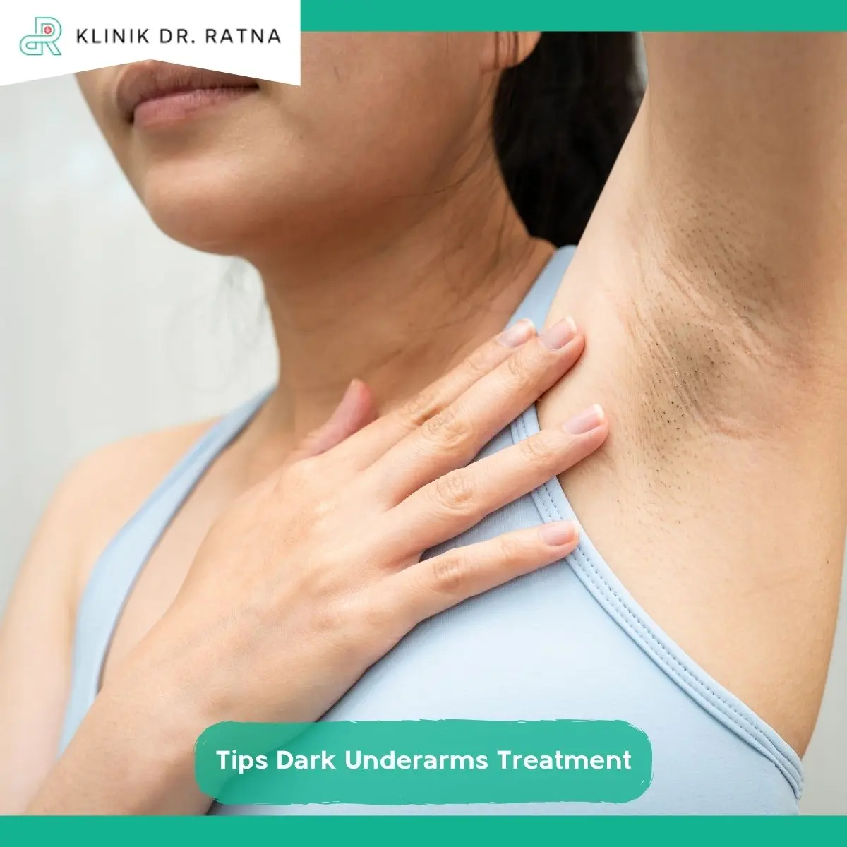 Cara Merawat Ketiak agar Hasil Treatment Lebih Optimal
