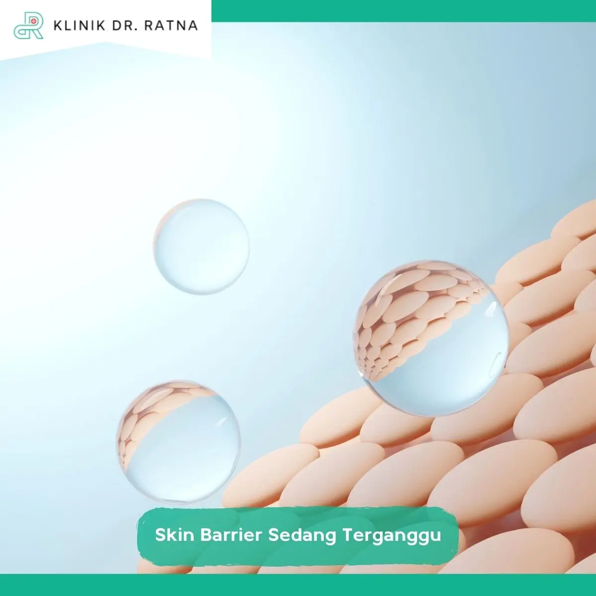 Kapan Kulit Perih dan Sensitif Perlu Diperiksa Dokter?
