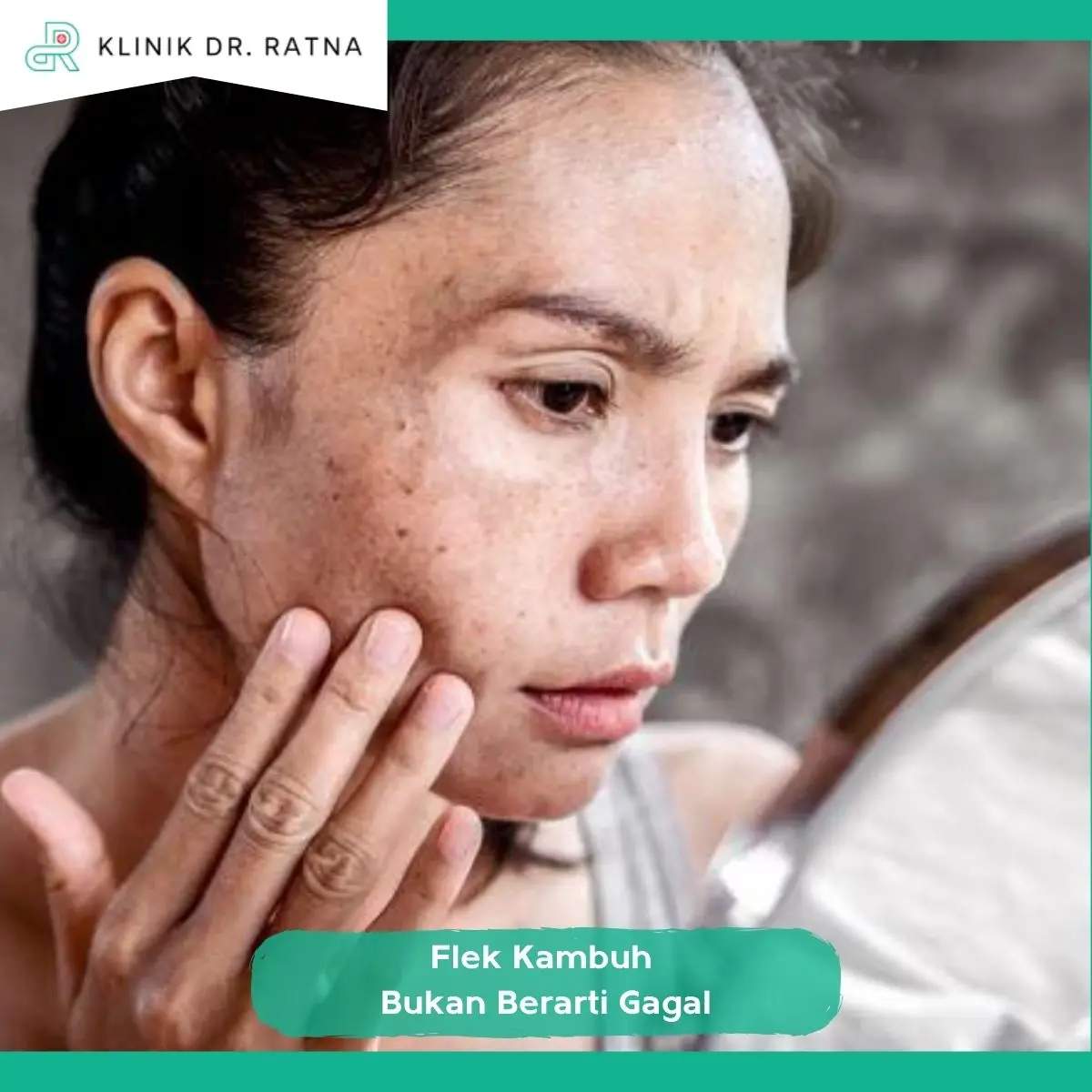 Apakah Flek yang Kambuh Berarti Perawatan Sebelumnya Gagal?