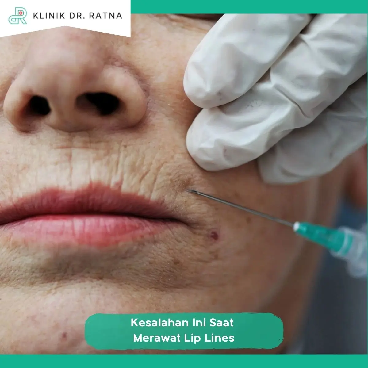 1. Jangan Hanya Fokus pada Garis Bibir yang Terlihat