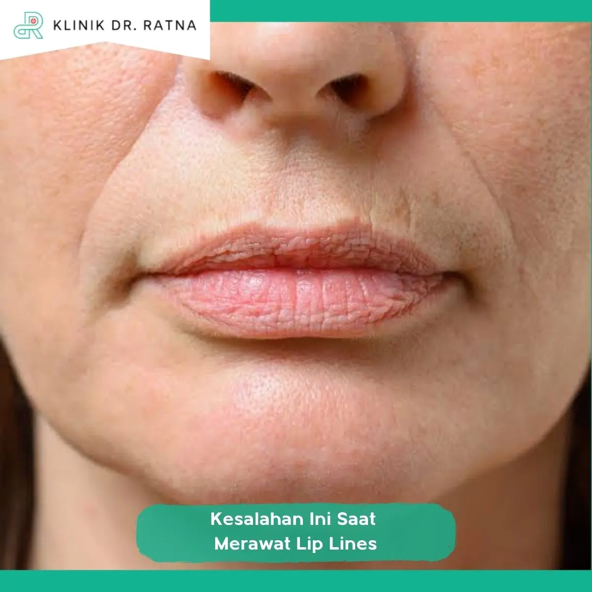 3. Jangan Menargetkan Garis Bibir Hilang Sepenuhnya