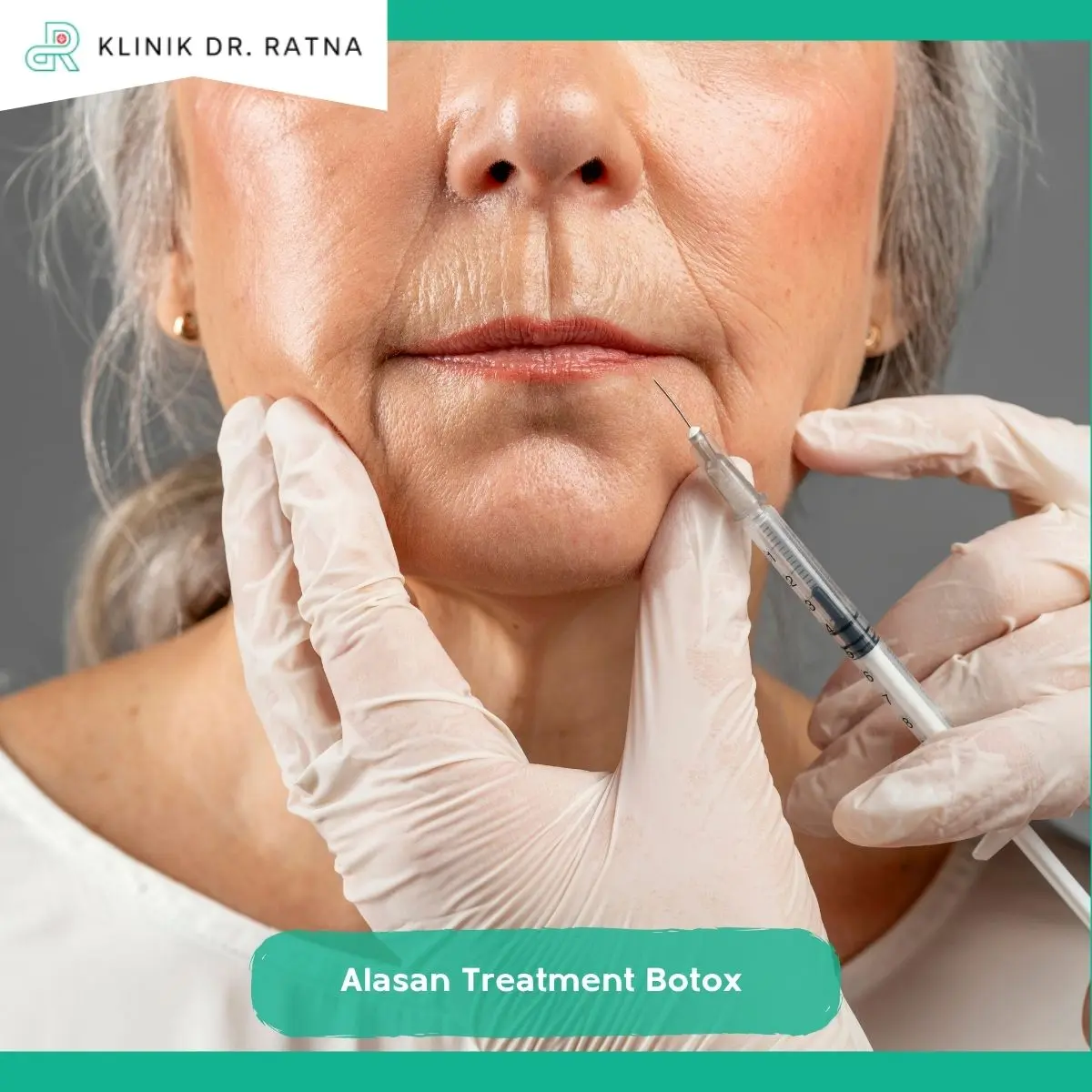 Area Wajah yang Umumnya Bisa Ditangani dengan Botox