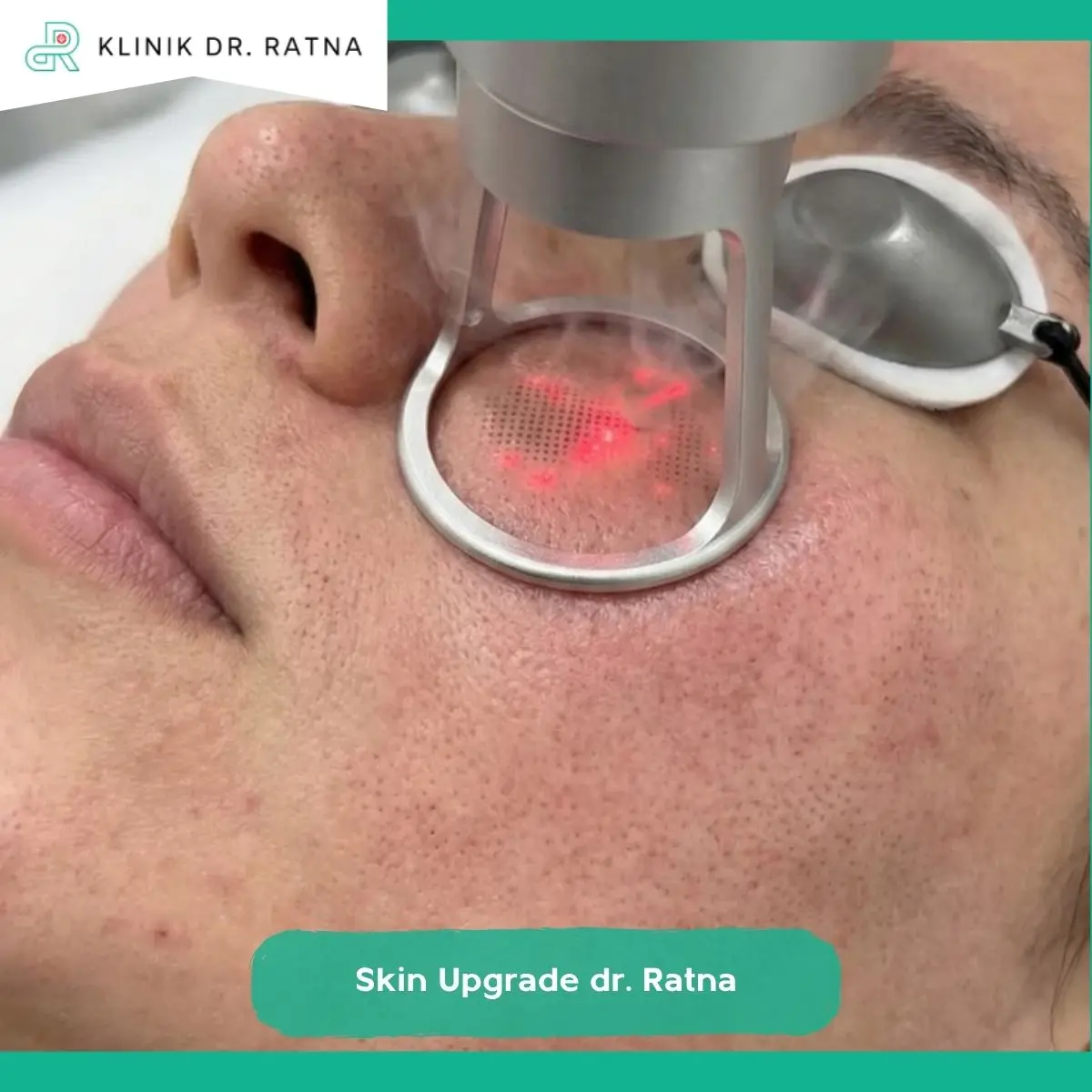 Usia Bukan Satu-satunya Penentu Pilihan Treatment Kulit